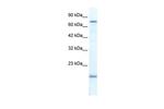 PGBD3 Polyclonal Antibody