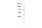 Connexin 30.3 Polyclonal Antibody