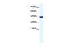 IBSP Polyclonal Antibody