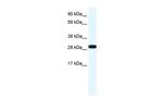 Annexin A4 Antibody in Western Blot (WB)