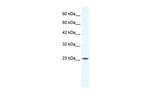 KCTD11 Antibody in Western Blot (WB)