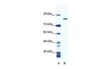 DHX16 Polyclonal Antibody