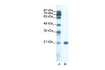 SSX2 Polyclonal Antibody