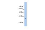 HMGN5 Polyclonal Antibody