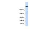 ZNF251 Antibody in Western Blot (WB)