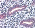 TWIST1 Antibody in Immunohistochemistry (IHC)