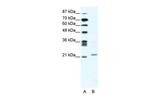 TWIST1 Antibody in Western Blot (WB)
