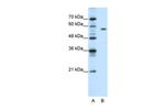 PBX2 Polyclonal Antibody