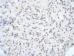 SMARCA1 Antibody in Immunohistochemistry (Paraffin) (IHC (P))