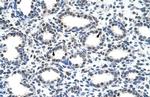 SMARCD2 Antibody in Immunohistochemistry (Paraffin) (IHC (P))