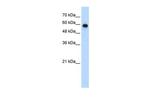 SMARCD2 Antibody in Western Blot (WB)