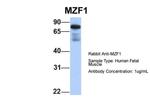 MZF1 Antibody in Western Blot (WB)