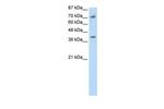 ZNF282 Antibody in Western Blot (WB)