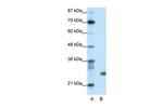 SAP30 Polyclonal Antibody