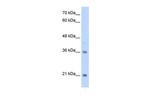 TCF15 Polyclonal Antibody