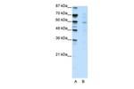 MTG16 Polyclonal Antibody