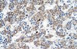 DLX5 Polyclonal Antibody