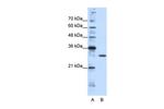 GSC2 Antibody in Western Blot (WB)