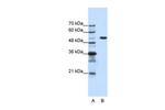 HCFC1 Polyclonal Antibody