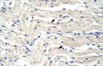 ELL Antibody in Immunohistochemistry (IHC)