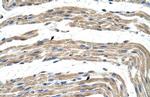 ZNF197 Polyclonal Antibody