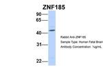 ZNF185 Polyclonal Antibody
