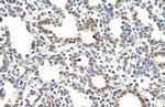 ZNF195 Antibody in Immunohistochemistry (IHC)
