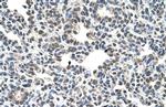CIZ1 Polyclonal Antibody