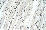 TRIM32 Polyclonal Antibody