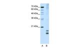 MAFF Polyclonal Antibody