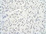 GMEB2 Antibody in Immunohistochemistry (Paraffin) (IHC (P))