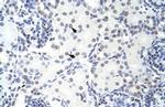 GMEB2 Polyclonal Antibody
