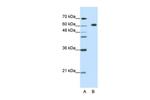 GMEB2 Antibody in Western Blot (WB)