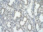 BRD7 Polyclonal Antibody