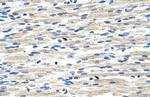 CBX6 Polyclonal Antibody