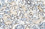 AKAP8L Polyclonal Antibody