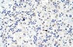 SART3 Polyclonal Antibody