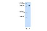 TOX4 Polyclonal Antibody