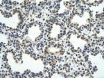 RCOR1 Antibody in Immunohistochemistry (Paraffin) (IHC (P))