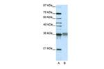 TLX2 Antibody in Western Blot (WB)