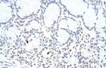 ZNF580 Polyclonal Antibody
