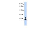PRRX2 Polyclonal Antibody