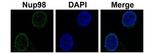 NUP98 Antibody in Immunohistochemistry (IHC)