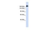 NUP98 Antibody in Western Blot (WB)