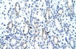 GTF2IRD1 Polyclonal Antibody