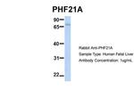 PHF21A Antibody in Western Blot (WB)