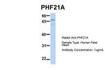 PHF21A Antibody in Western Blot (WB)