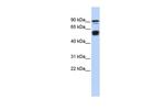 BCL11A Antibody in Western Blot (WB)