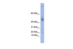 POLE4 Polyclonal Antibody