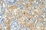 NR2F2 Polyclonal Antibody